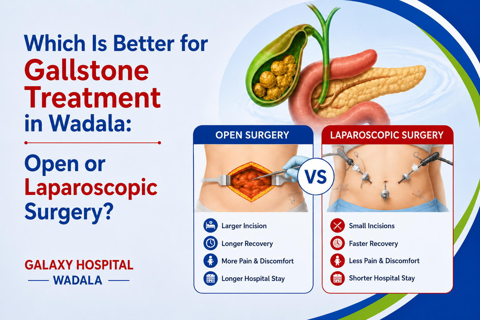 Gallstone Treatment in Wadala